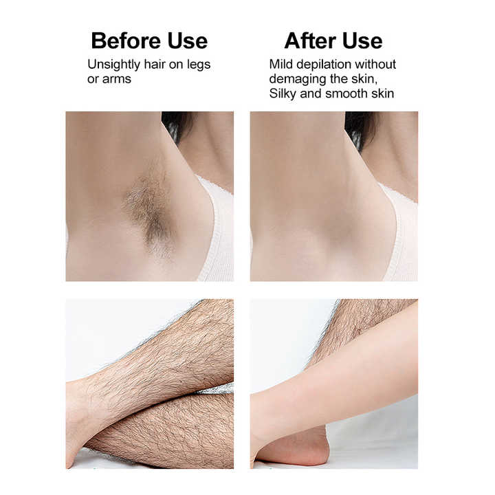 Crystal Hair Removal