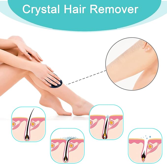 Crystal Hair Removal