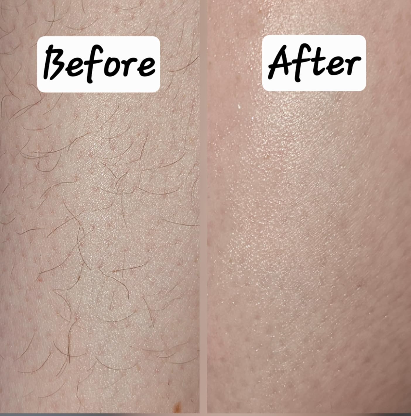 Crystal Hair Removal